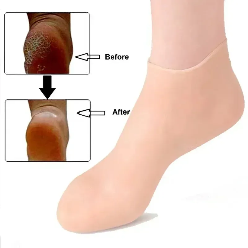 Silicon full shape moisturising socks